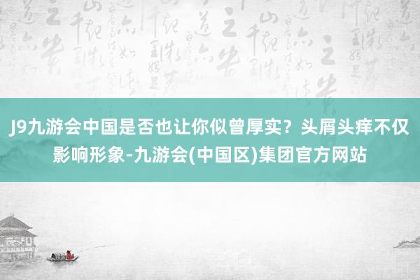 J9九游会中国是否也让你似曾厚实？头屑头痒不仅影响形象-九游会(中国区)集团官方网站